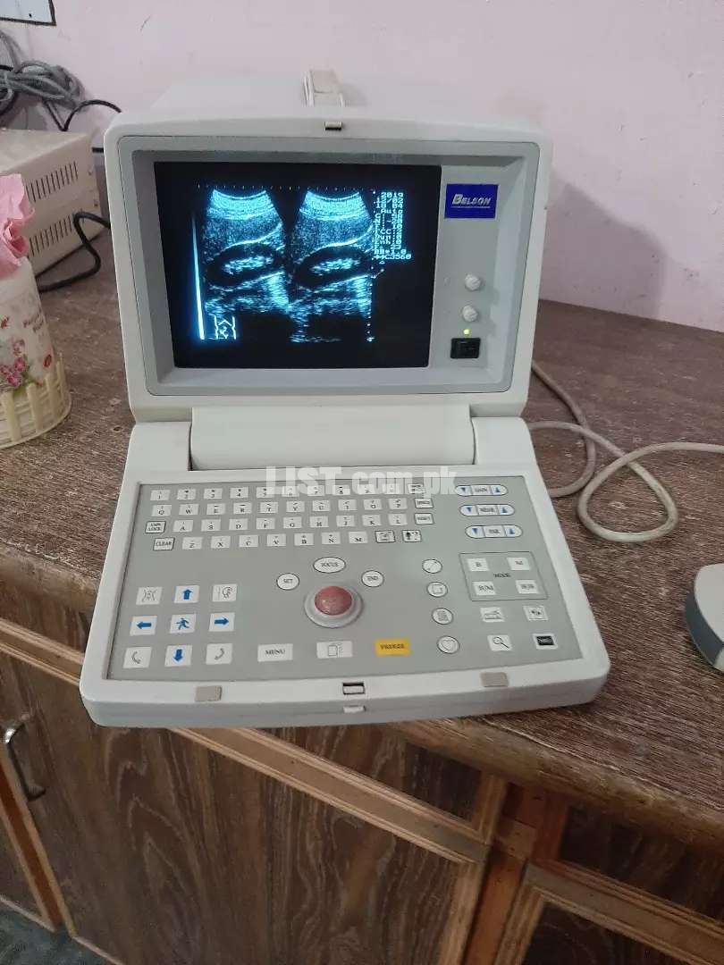 Used china Belson 200c ultrasound machine with convex probe