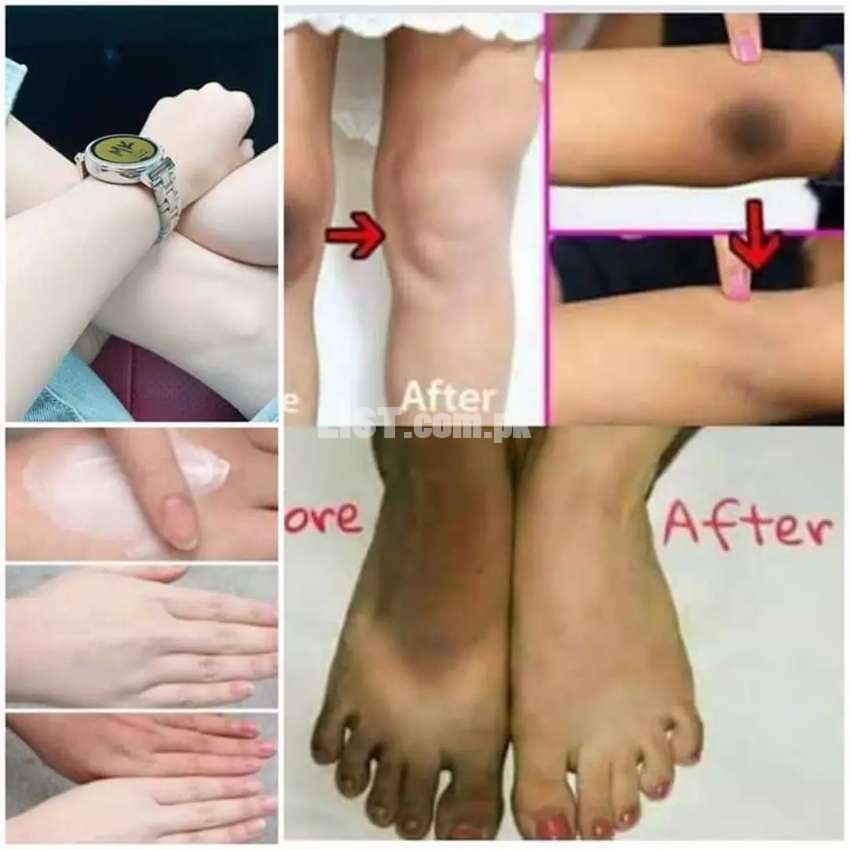 Hand feet whitening cream