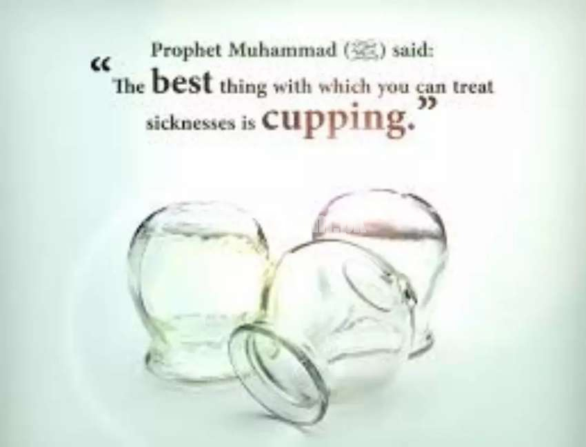 "Hijama is not only Therapy, it is Sunnah and also Cure of Diseases"
