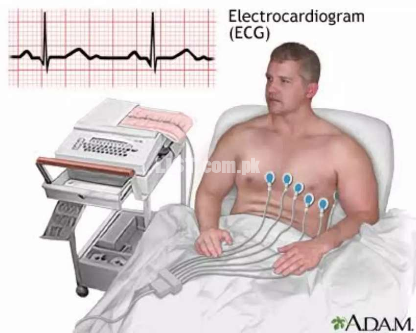 ECG Heart Scanning facility at your Home - Karachi