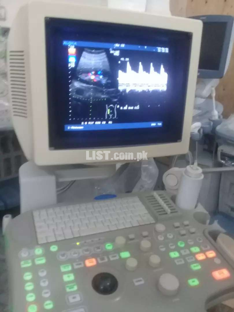 Aloka 3500sv ultrasound