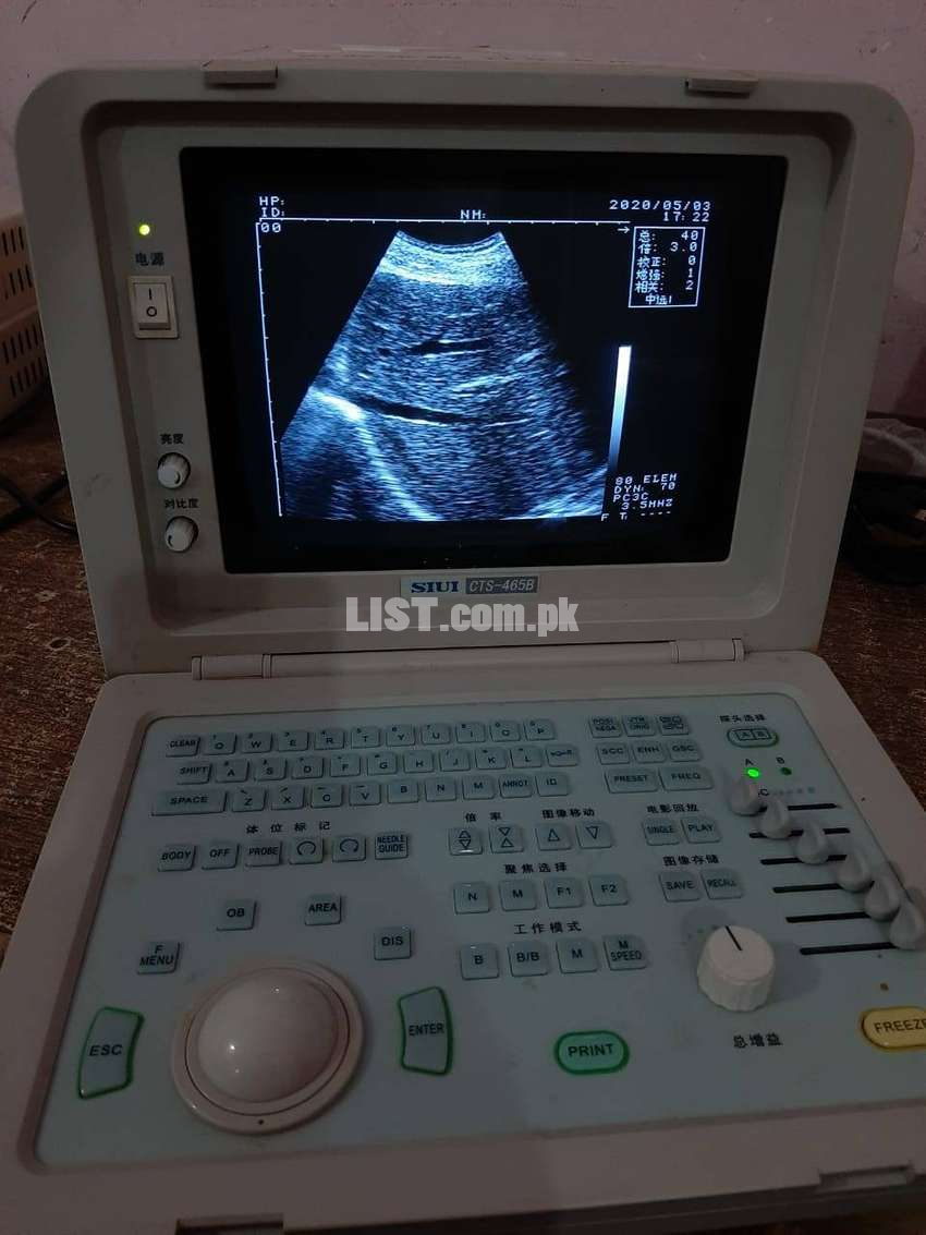 Chinese Ultrasound Machine used and new