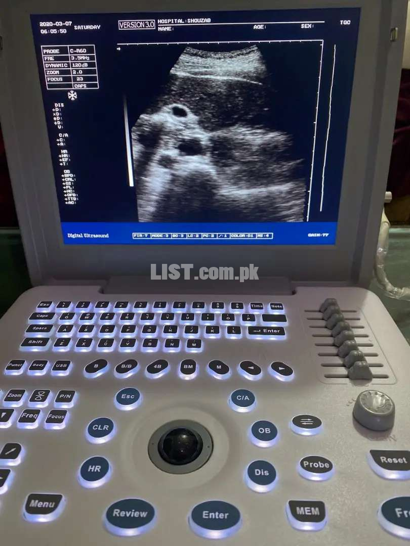 Apollo 7 digital ultrasound machine brand new