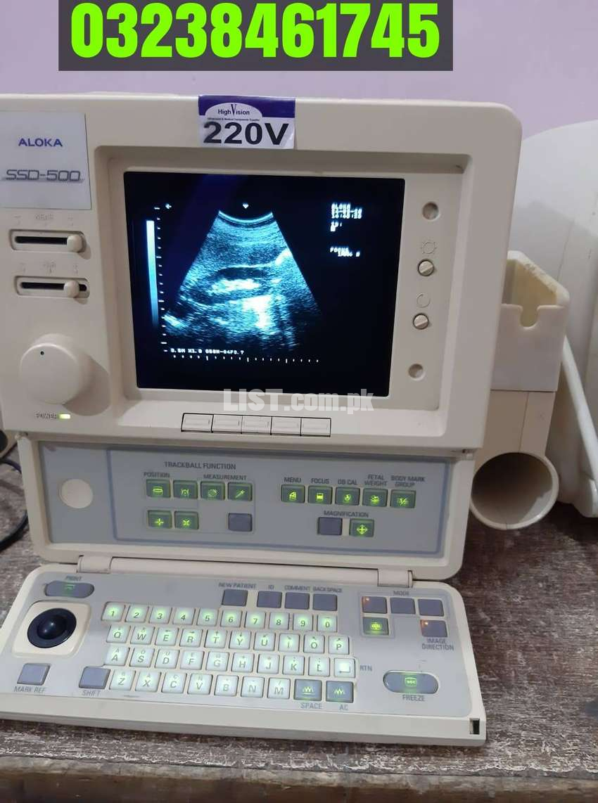 Aloka 500 portable japanese Ultrasound machine with convex probe