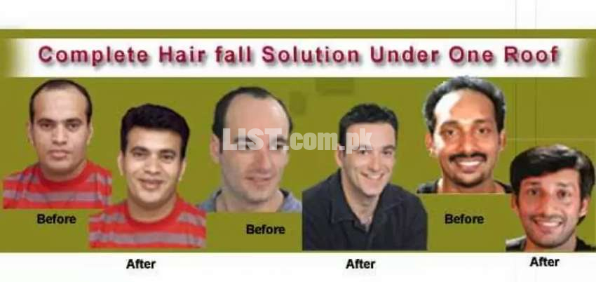 Hair Fixing centre Starting only 12000 100% Human hairs unit And Cap