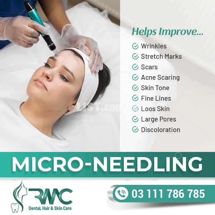 Microneedling Treatment - Microneedling for acne scars - Microneedling