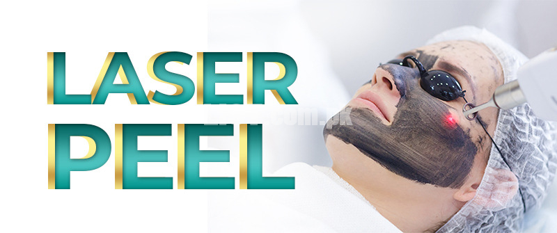 Laser Carbon Peel Treatment in Islamabad - Rehman Medical Center