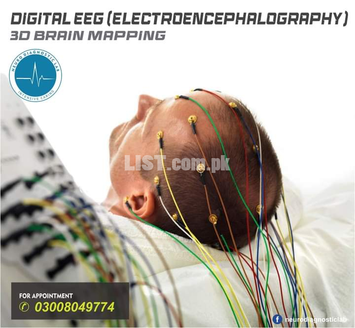 EEG test (Electroencephalogram)