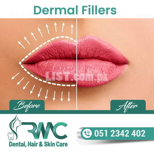 Dermal Fillers Injections in Islamabad - Dermal Fillers Treatment -RMC