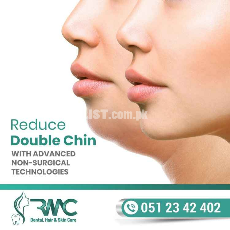 Double Chin Removal in Islamabad - Double Chin Reductions - RMC