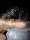 The Hair Doctors (Hair transplant & Hair patches )