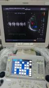 Ultrasound Toshiba Aplio