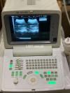 Chison 600 ultrasound in best condition