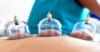 Hijama Therapy ( cupping ) from an expert