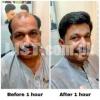 Hair patch, hair wig, hair system for sale in Karachi