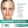 Vampire Facelift - Vampire facial - Facial PRP