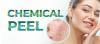Chemical peel Treatment in Islamabad - Rehman Medical Center
