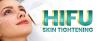 Hifu Treatment For Skin Tightening in Islamabad - R M C