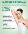 Full Body Laser Hair Removal in Islamabad - R M C