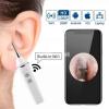 Wireless WiFi Otoscope Ear Camera Earwax Removal Tool|Surgical hut
