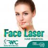 Laser Hair Removal Clinic in Islamabad - Full body Laser Hair - RMC
