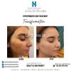 Pigmentation and Melasma Specialist